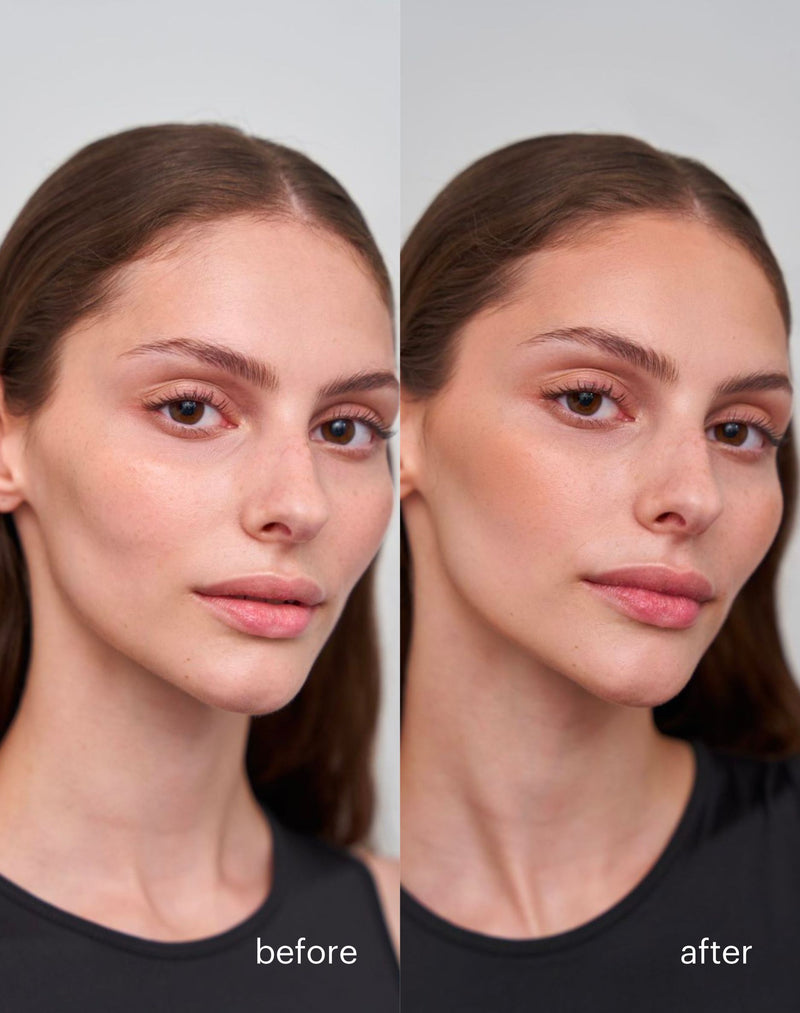 ; Regina Light Before - After