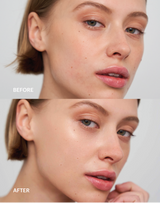 ; Ksenia Light Before - After