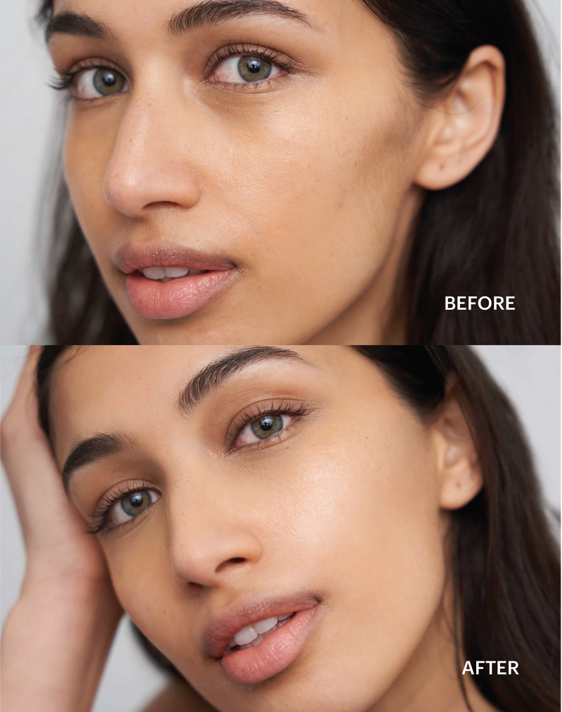 Before-after-CCCream2  3001 × 3800 Pixel  medium; Yashvi Before - After